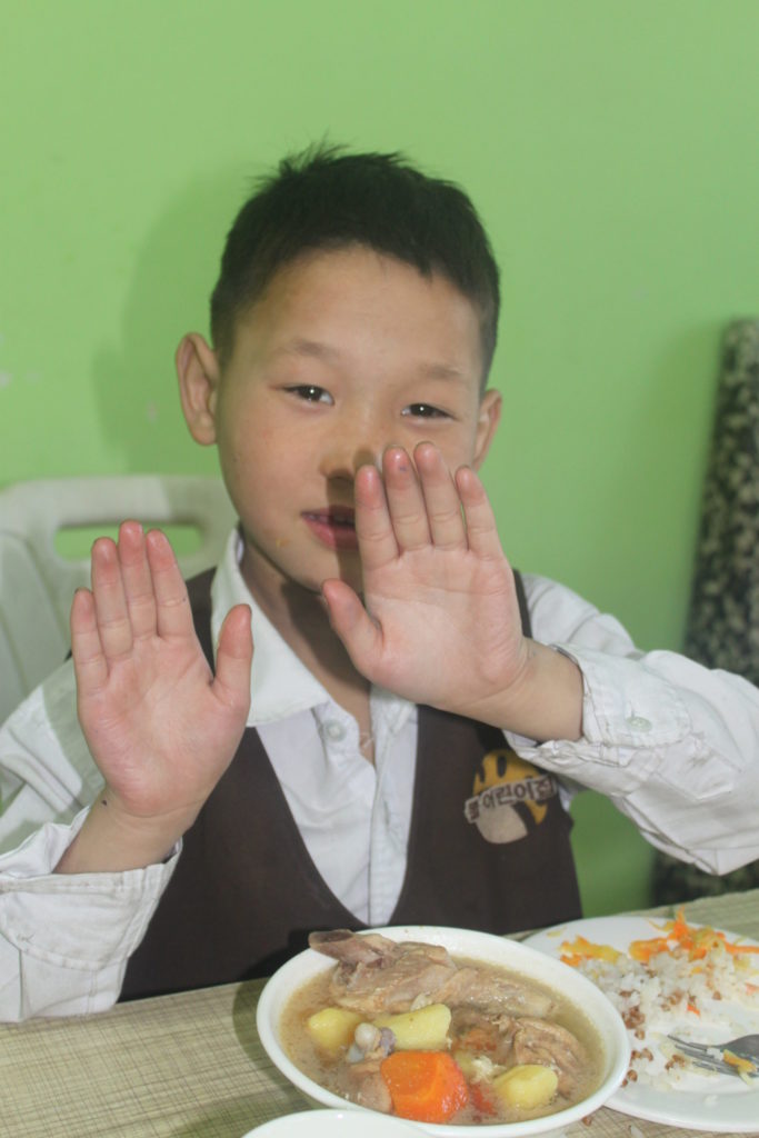 Munkh's hands are now completely healed! He is shown here holding up his hands.