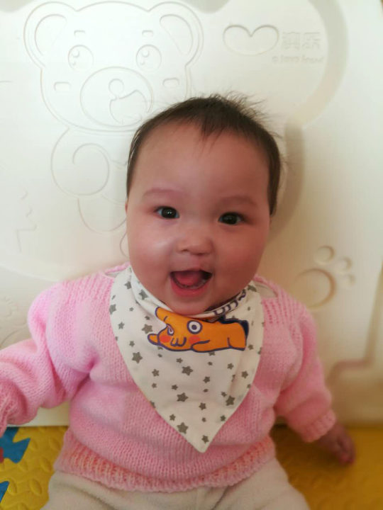 Rebekah after her first clef lip surgery in China. 