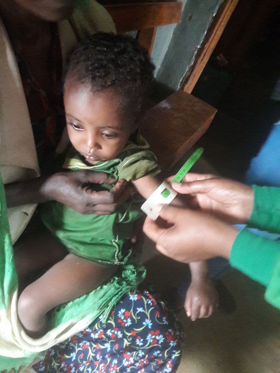 A boy is assessed for malnutrition in Ethiopia