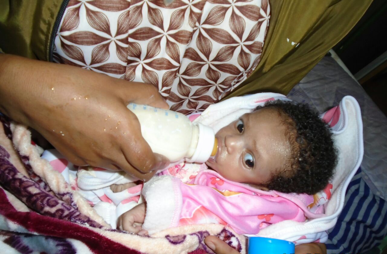 malnutrition in Ethiopia