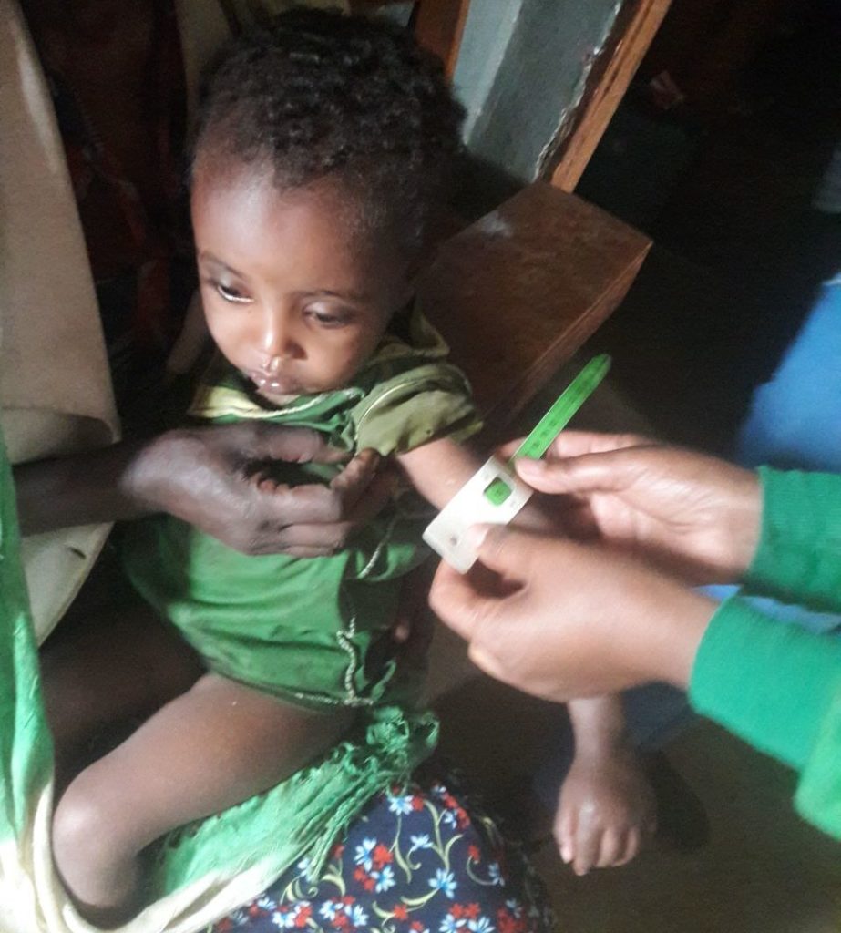 Ethiopia nutrition screening