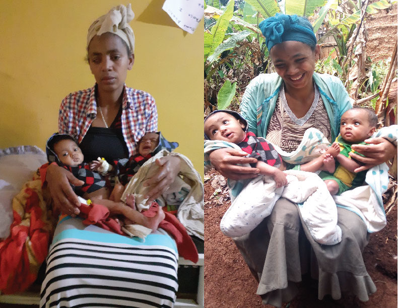 two photos side by side showing mother and twin babies before nutrition support and after