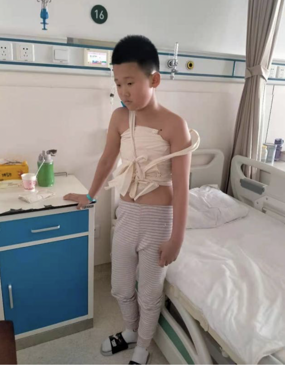 boy in China wrapped in bandages after heart surgery