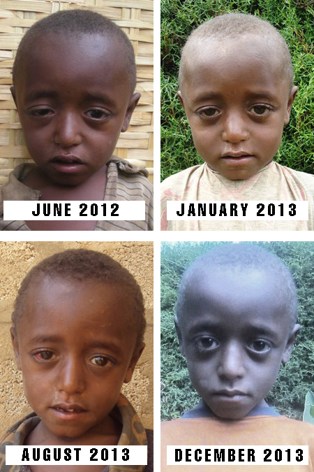 A boy transformation in Ethiopia