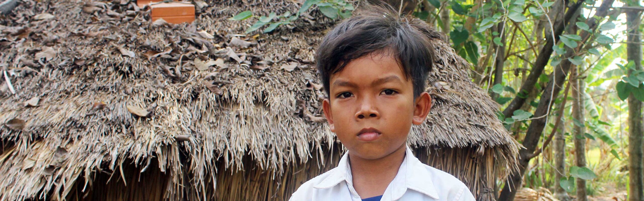 Young boy in Cambodia with a heart condition